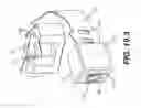 Fig. 59 - Coiling implantable prostheses