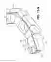 Fig. 61 - Coiling implantable prostheses