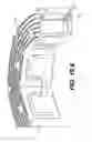 Fig. 62 - Coiling implantable prostheses