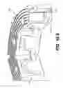 Fig. 64 - Coiling implantable prostheses