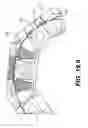 Fig. 65 - Coiling implantable prostheses