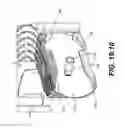 Fig. 66 - Coiling implantable prostheses