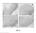 Fig. 04 - CELL-NANOFIBER COMPOSITE AND CELL-NANOFIBER-HYDROGEL COMPOSITE AMALGAM BASED ENGINEERED INTERVERTEBRAL DISC