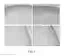 Fig. 05 - CELL-NANOFIBER COMPOSITE AND CELL-NANOFIBER-HYDROGEL COMPOSITE AMALGAM BASED ENGINEERED INTERVERTEBRAL DISC