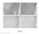 Fig. 06 - CELL-NANOFIBER COMPOSITE AND CELL-NANOFIBER-HYDROGEL COMPOSITE AMALGAM BASED ENGINEERED INTERVERTEBRAL DISC