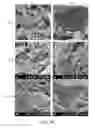 Fig. 08 - CELL-NANOFIBER COMPOSITE AND CELL-NANOFIBER-HYDROGEL COMPOSITE AMALGAM BASED ENGINEERED INTERVERTEBRAL DISC