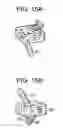 Fig. 10 - Zero profile spinal fusion cage