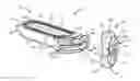 Fig. 01 - Spinal implant system and method