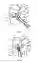 Fig. 12 - Spinal implant system and method