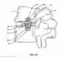Fig. 14 - Spinal implant system and method