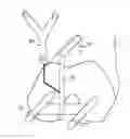 Fig. 01 - System for determining the position of a knee prosthesis