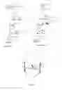 Fig. 02 - System for determining the position of a knee prosthesis