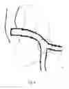 Fig. 04 - Medical stent