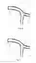 Fig. 05 - Medical stent
