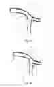 Fig. 06 - Medical stent