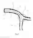 Fig. 07 - Medical stent