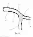 Fig. 10 - Medical stent