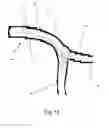 Fig. 11 - Medical stent