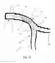 Fig. 13 - Medical stent