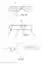 Fig. 16 - Medical stent