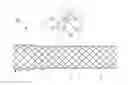 Fig. 01 - METHOD OF MANUFACTURING ANTI-MIGRATION STENT AND STENT MANUFACTURED THEREBY