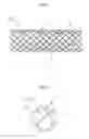 Fig. 02 - METHOD OF MANUFACTURING ANTI-MIGRATION STENT AND STENT MANUFACTURED THEREBY