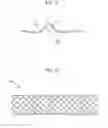 Fig. 06 - METHOD OF MANUFACTURING ANTI-MIGRATION STENT AND STENT MANUFACTURED THEREBY
