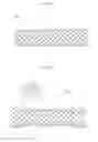 Fig. 07 - METHOD OF MANUFACTURING ANTI-MIGRATION STENT AND STENT MANUFACTURED THEREBY