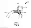 Fig. 03 - VASCULAR IMPLANT FOR TREATING ANEURYSMS