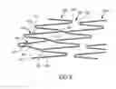 Fig. 07 - VASCULAR IMPLANT FOR TREATING ANEURYSMS