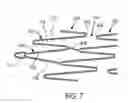 Fig. 08 - VASCULAR IMPLANT FOR TREATING ANEURYSMS
