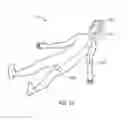 Fig. 14 - VASCULAR IMPLANT FOR TREATING ANEURYSMS