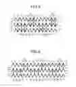 Fig. 08 - Stent