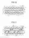 Fig. 09 - Stent
