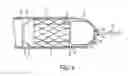 Fig. 06 - Expanding sheath tip
