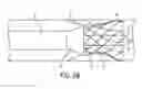 Fig. 09 - Expanding sheath tip