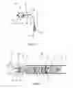 Fig. 02 - Method of retrieving a retrievable device and an assembly of the retrievable device and a retrieving element