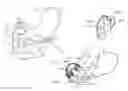 Fig. 01 - PANCREATICOBILIARY DIVERSION DEVICE