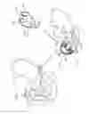Fig. 02 - PANCREATICOBILIARY DIVERSION DEVICE