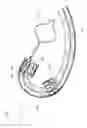Fig. 04 - PANCREATICOBILIARY DIVERSION DEVICE