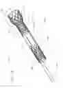 Fig. 07 - PANCREATICOBILIARY DIVERSION DEVICE