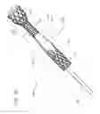 Fig. 08 - PANCREATICOBILIARY DIVERSION DEVICE