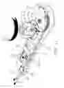 Fig. 13 - Traction device for neck physical therapy