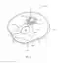 Fig. 04 - Fecal matter containment device
