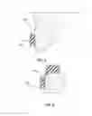Fig. 06 - Method for vacuum-forming dental appliance