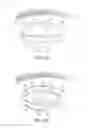 Fig. 03 - Controller for dry eye treatment systems