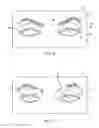 Fig. 07 - Controller for dry eye treatment systems