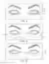 Fig. 08 - Controller for dry eye treatment systems