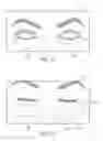 Fig. 10 - Controller for dry eye treatment systems