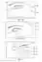 Fig. 11 - Controller for dry eye treatment systems